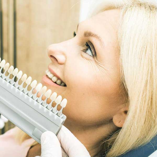 Veneers